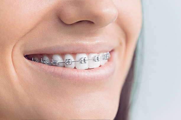 Best Invisalign and Clear Aligners  in Las Quintas Fronterizas, TX
